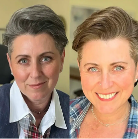 Before & After Caroline T.